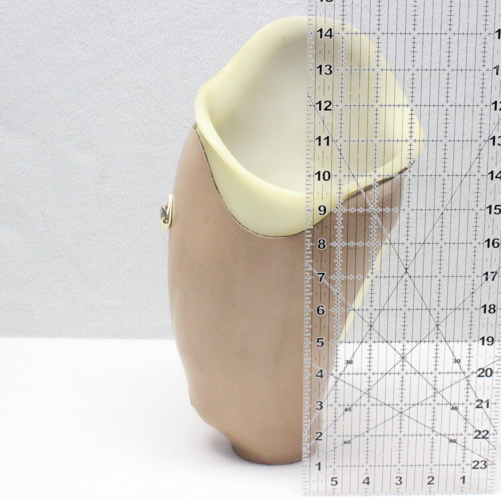 ABOVE KNEE PROSTHETIC LEFT LEG SOCKET SYSTEM w/ KISS DISTAL ~W=5.5×6″ H=9.5×14″