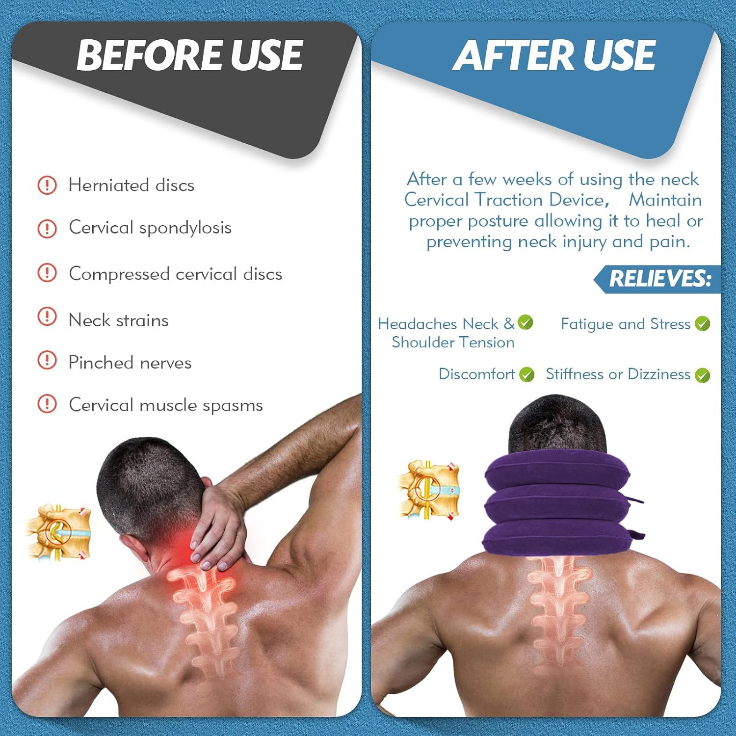 Neck Stretcher, Neck Traction Device for Instant Neck Pain Relief | Adjustable I