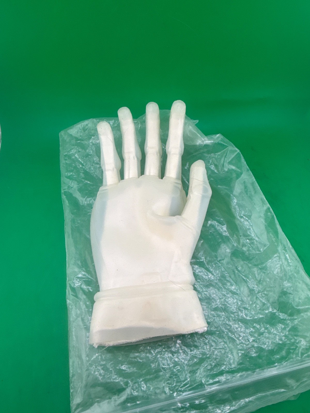 Ilimb Ossur touch bionics right prosthetic hand cover, medium, new, reinforced
