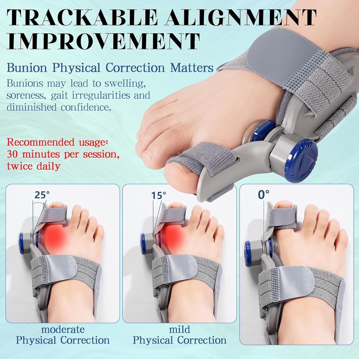 New Upgrade Treatmedy Bunion Corrector for Women & Men, Adjustable Bunion Fix Sp