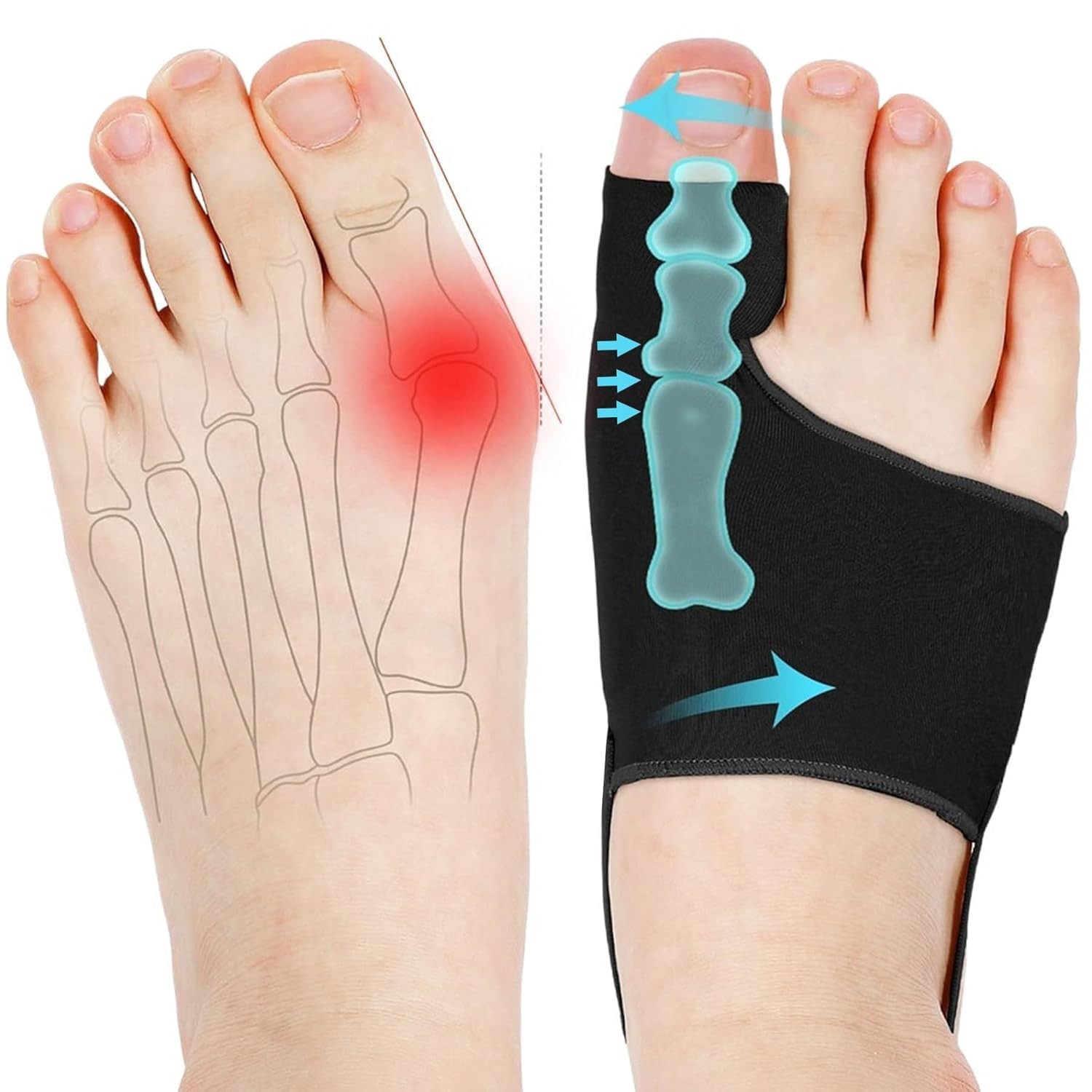 WELEQUT 2PCS Bunion Corrector for Women & Men – Toe Alignment Medium, Black