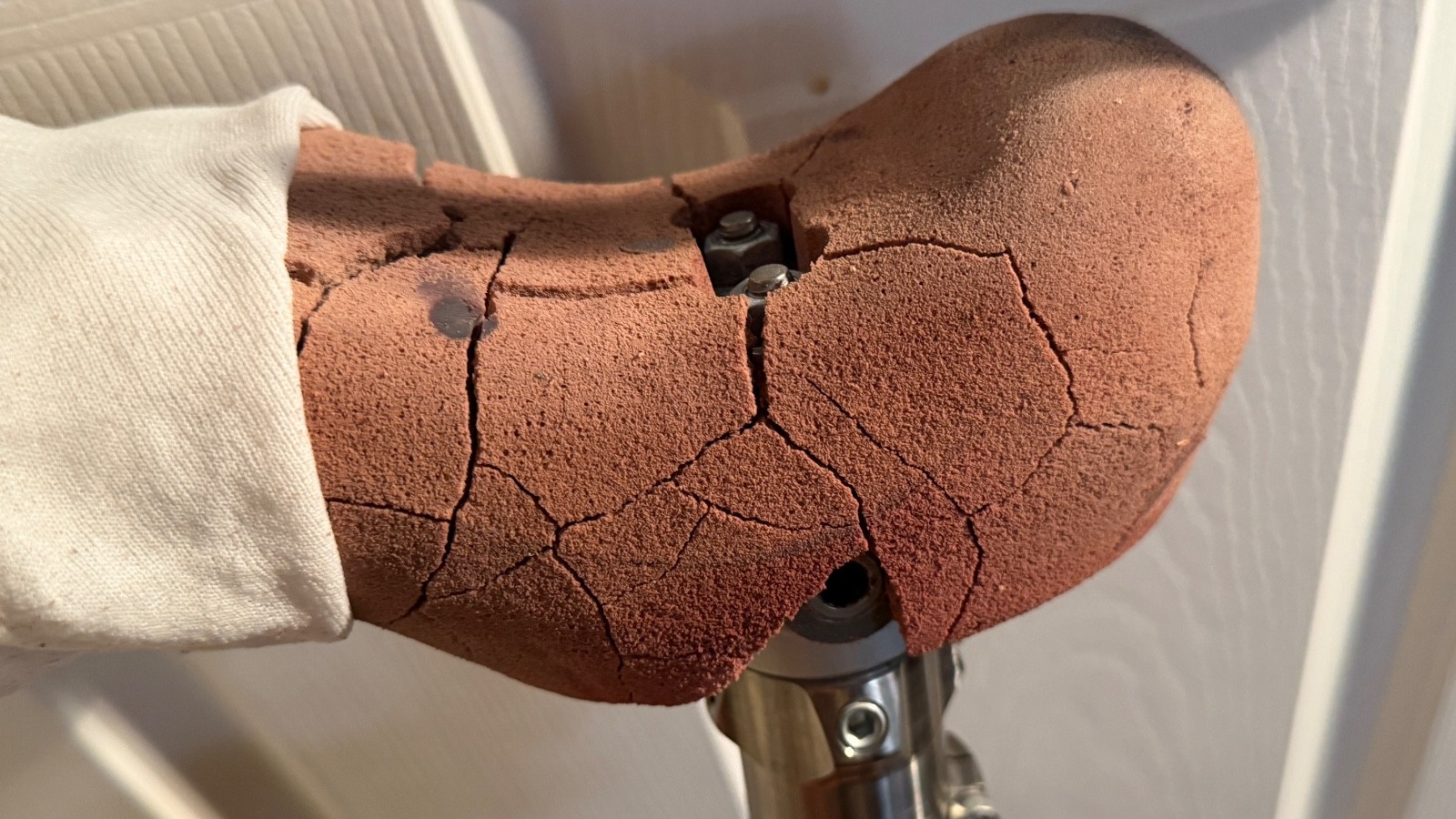 Vintage Ottobock Titan Left – Above the knee with Original Stub
