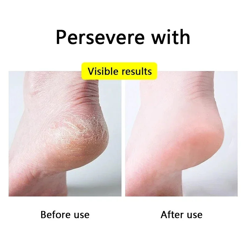 Silicone Feet Pads for Heel Moisturizing Socks Open Toe Socks Cracked Foot Toele