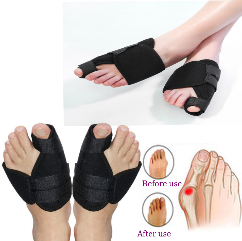 Bunion Splints Foot Big Toe Pain Relief Hallux Valgus Splint Brace – PAIR