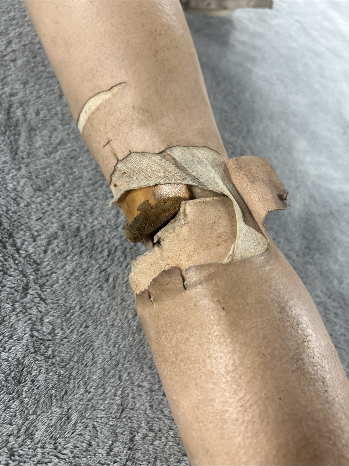 Vintage Left Above Knee Prosthetic Leg Please Read