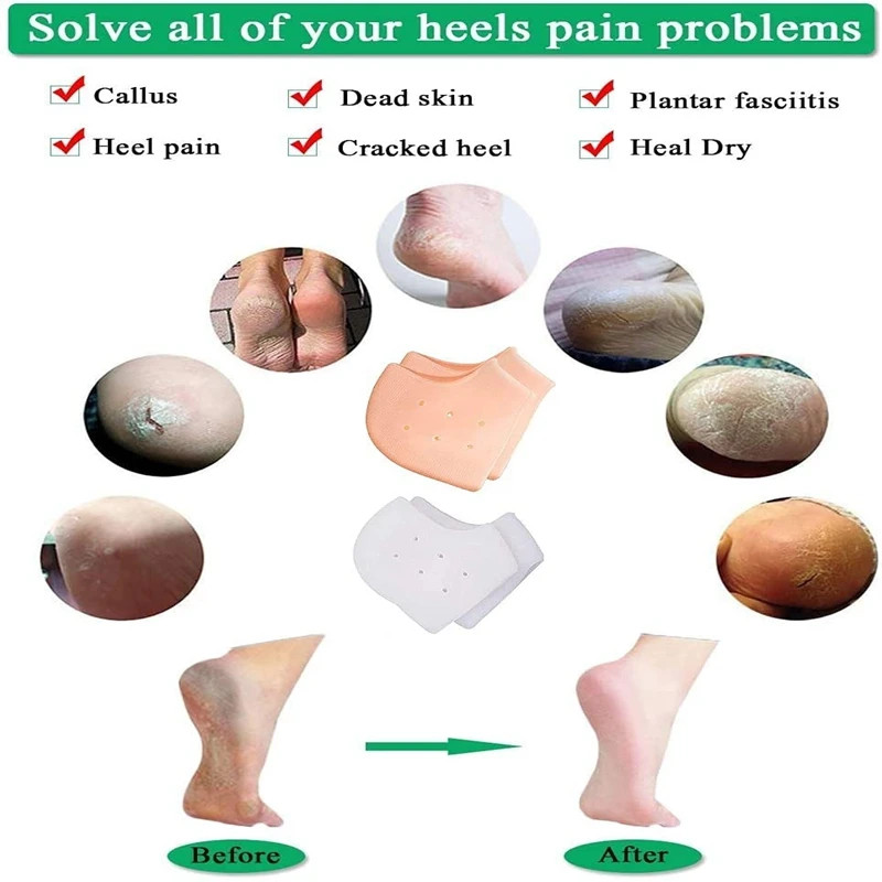 2Pcs Silicone Feet Care Socks Moisturizing Gel Heel Thin Socks with Hole Cracked