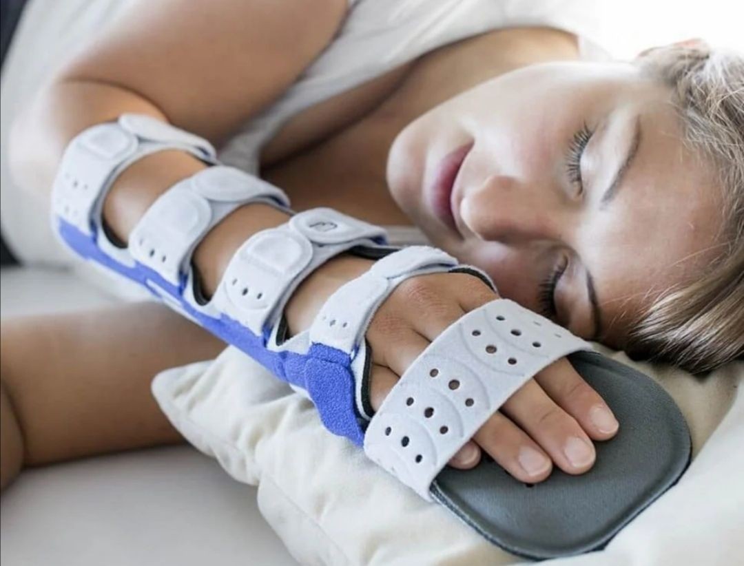 Bauerfeind ManuLoc Long Plus Hand Orthosis Immobilizing Size 3 L-XL