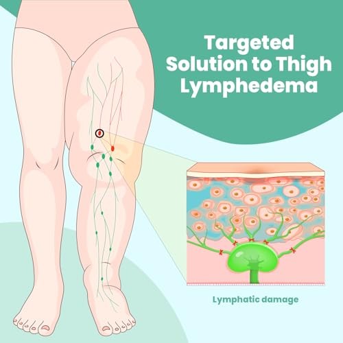 iDonua® Swollen Thigh Compression Wrap Brace for Lymphedema Reduction – with …