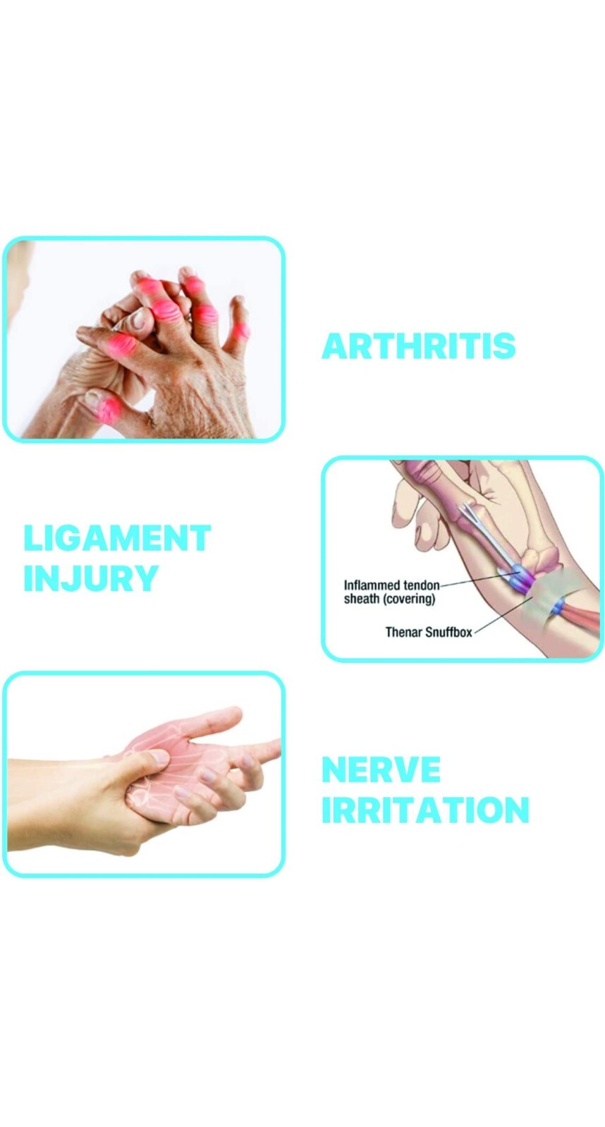 BreoLife Arthritis Gloves Compression XL. Does Not Interfere With Daily Work.