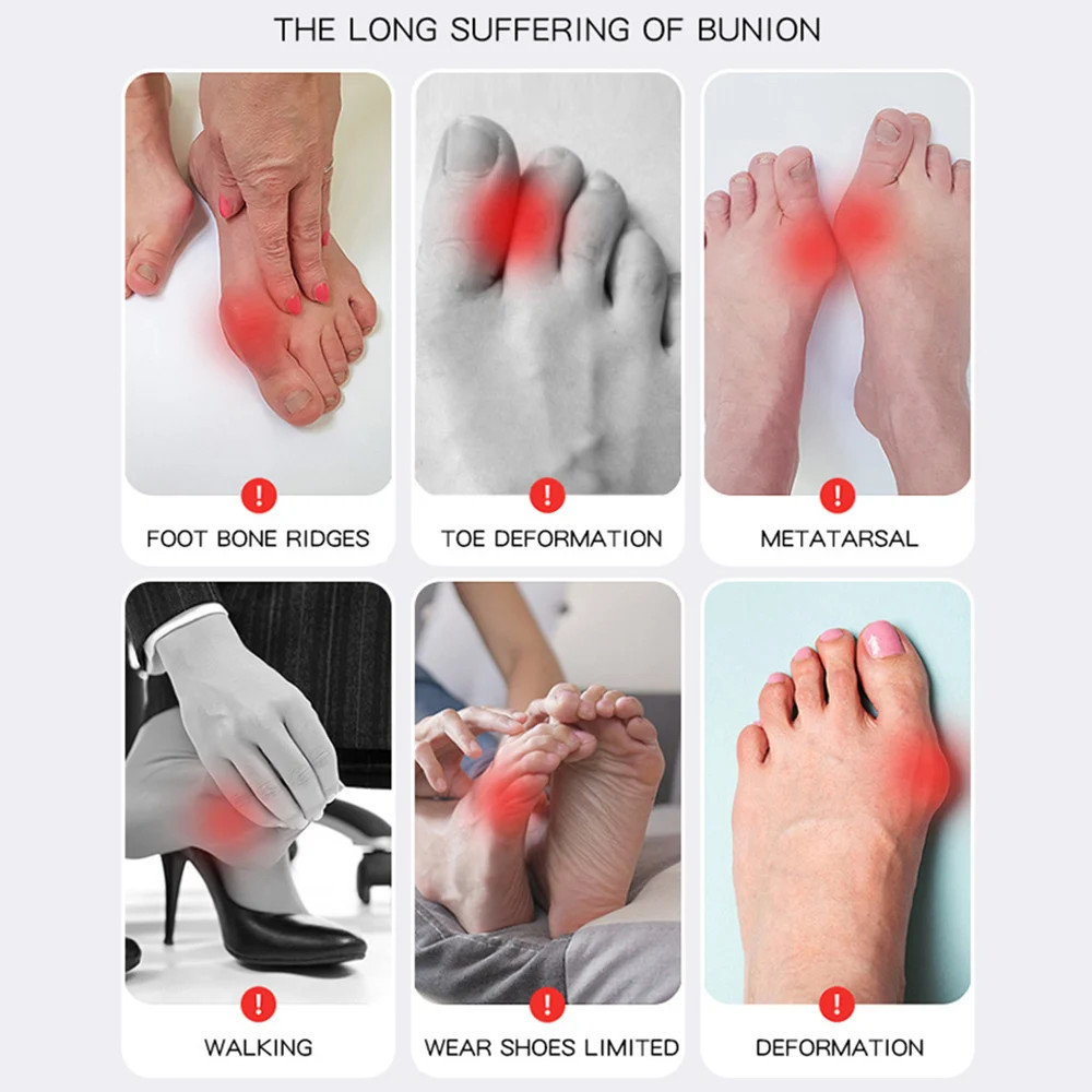 Adjustable Bunion Corrector Sock Toe Separator Pain Relief Foot Tool 1 Pc