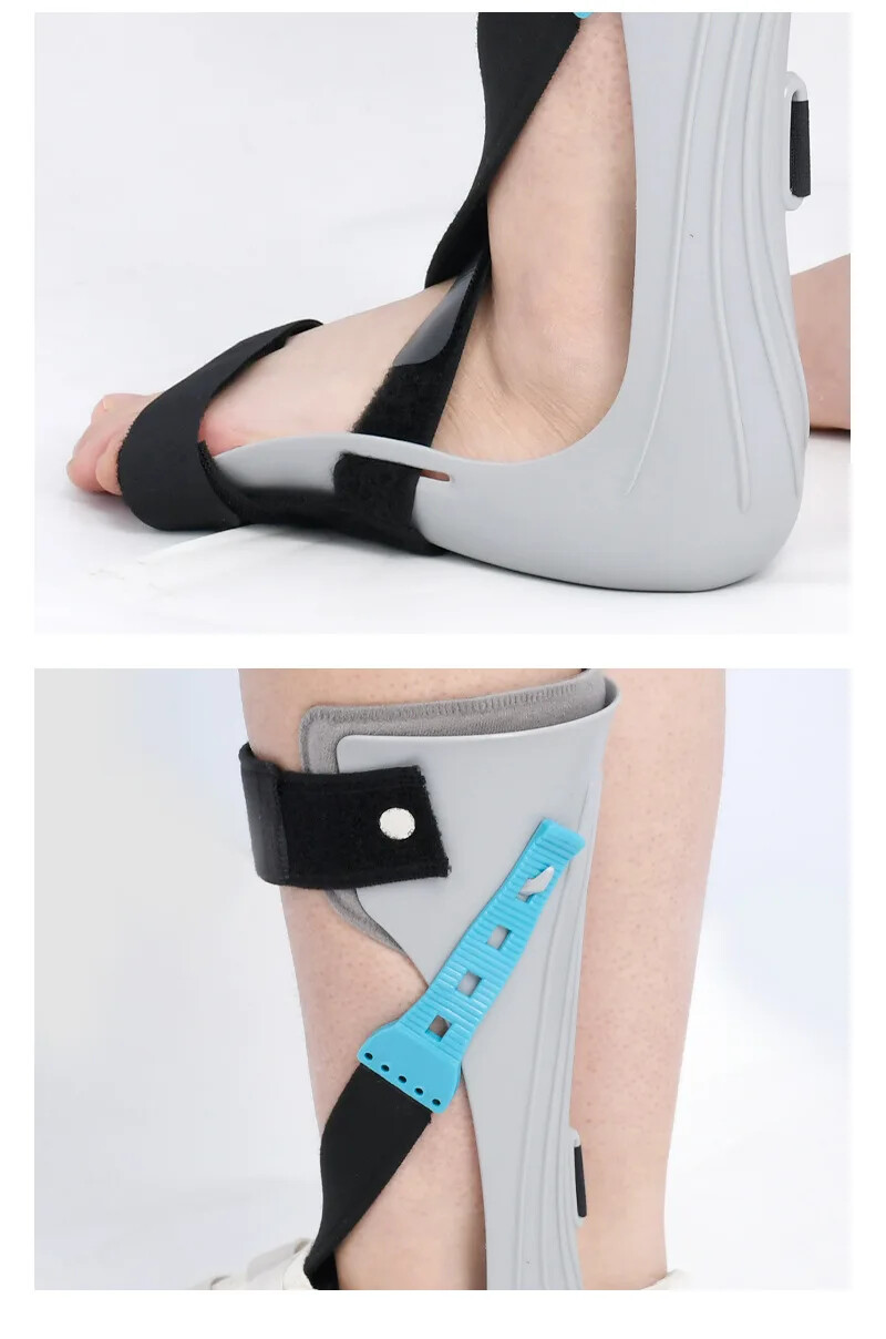 Correction of Stroke Hemiplegia and Ankle Joint Fixation with Foot Drop Orthosis