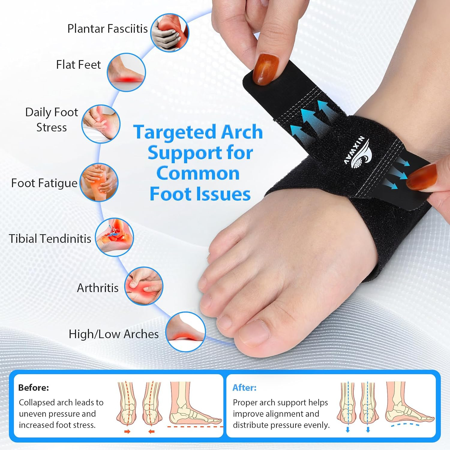 Arch Support Braces (10PCS) for Plantar Fasciitis Relief, Adjustable Compression