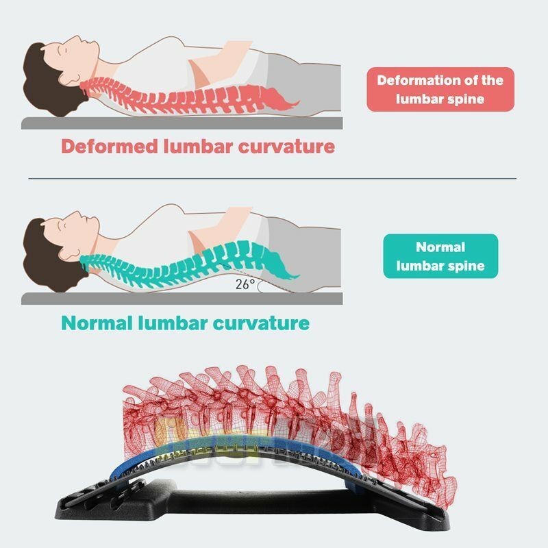 Multi-Level Back Stretcher Lumbar Support Device Pain Spine Relief & Posture Aid