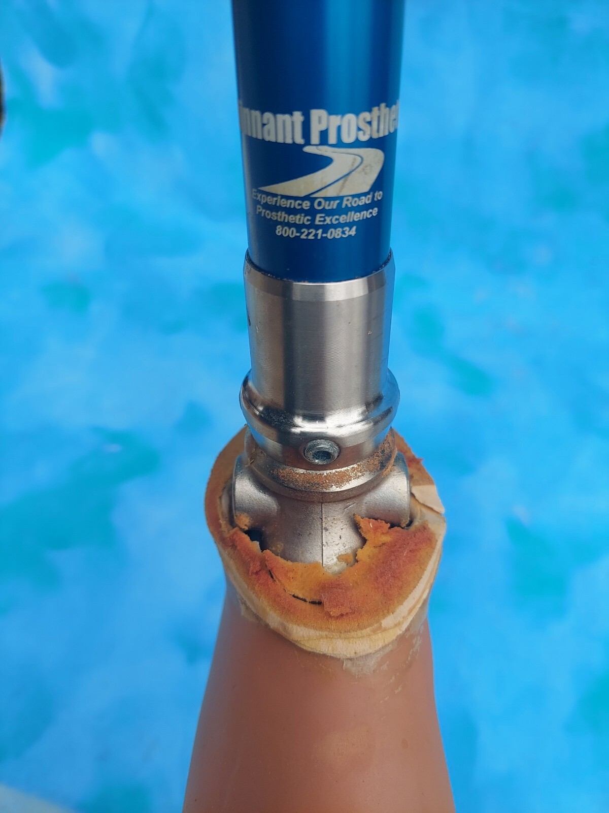 Medi Prosthetic Above Knee Leg Limb OSSUR RIGHT Foot Size 25