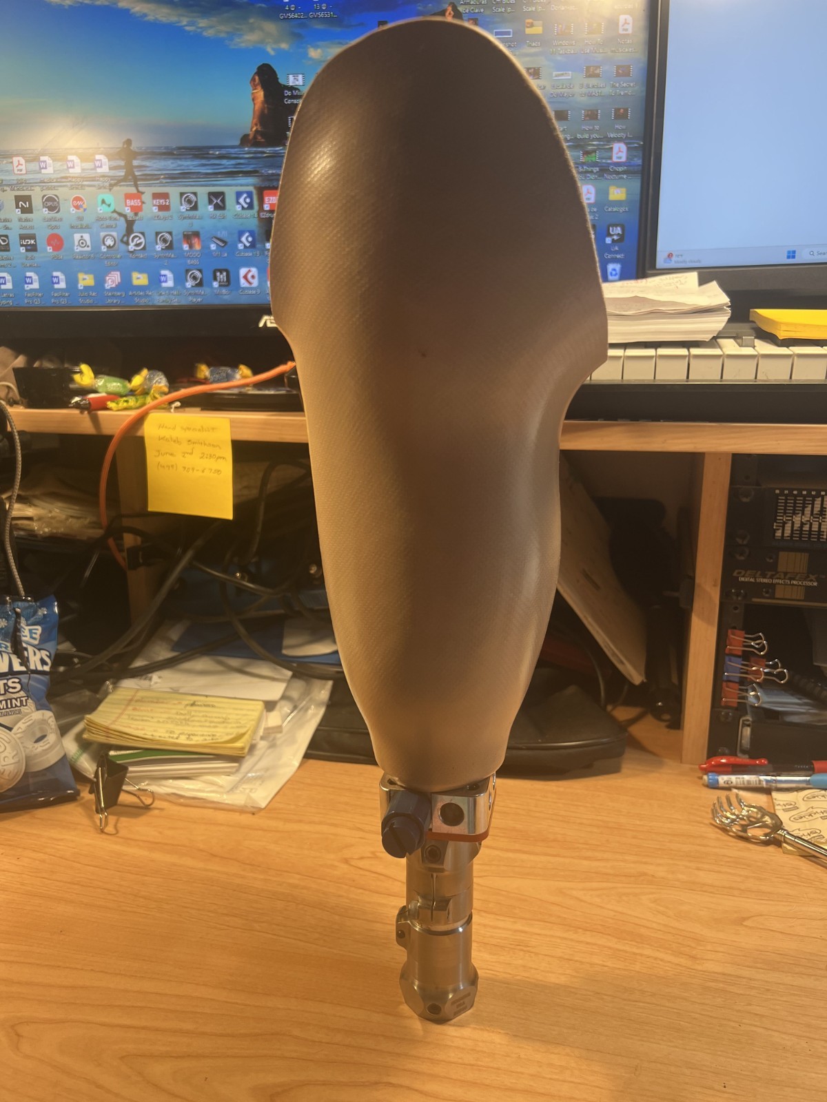 Prosthetic Socket with components. Right leg. Below Knee (BK). USED