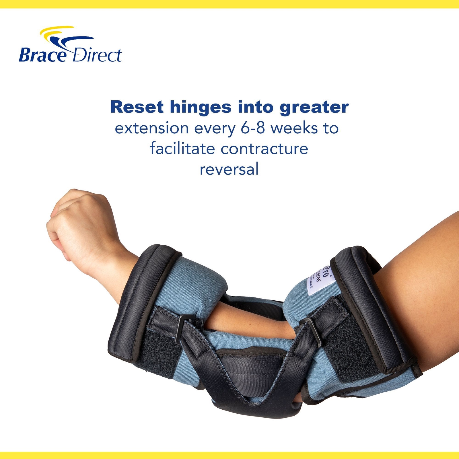 DynaPro Flex Elbow Brace for Contractures – L3760 – OCSI by Brace Direct