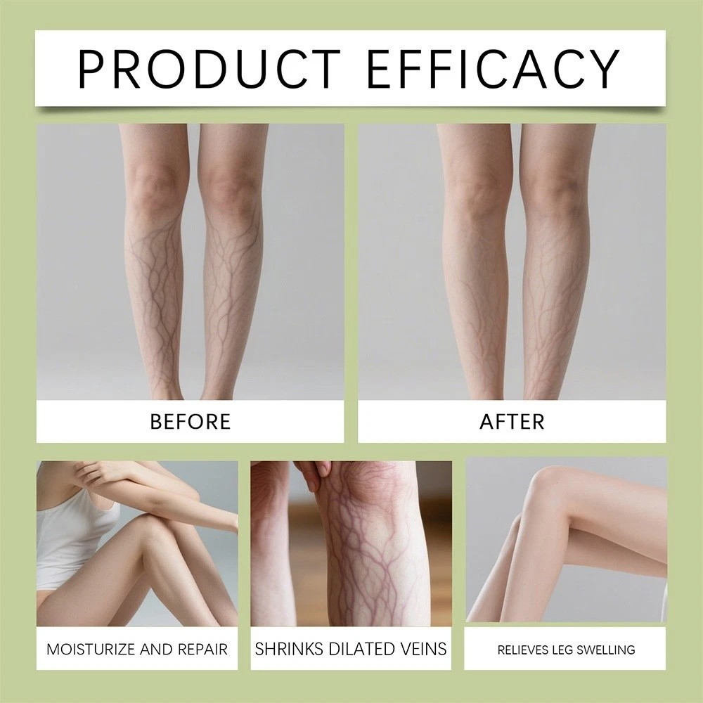Vein Repair Microneedle Patch Roll, Vein Repair Patches, Professional Treatment