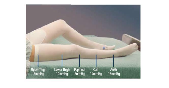 McK T.E.D.™ Knee High 2 X-Large, Regular Anti-embolism Stockings #7470LF