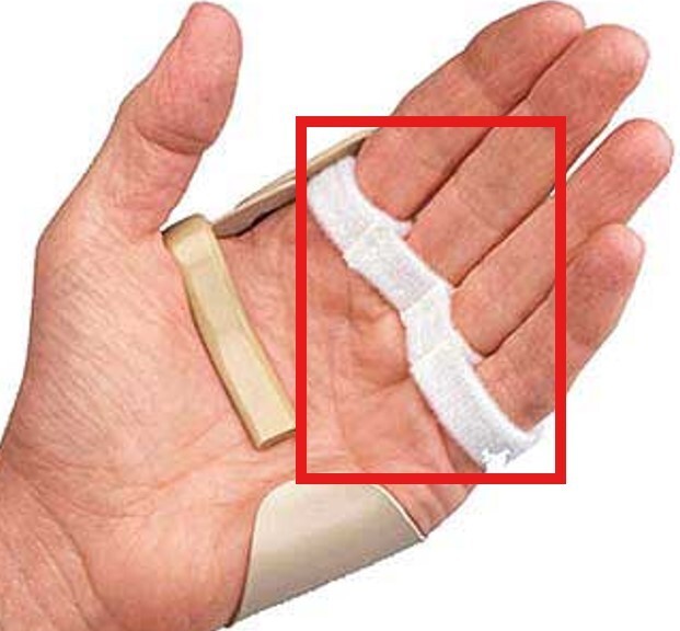 3pp Radial Replacement Straps – 2 Count – Small/Medium