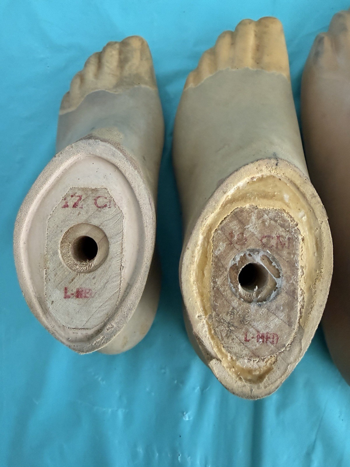 lot of 5 USED PROSTHETIC FEET. 3 OTTO BOCK -2 KINGSLEY JUVENILE