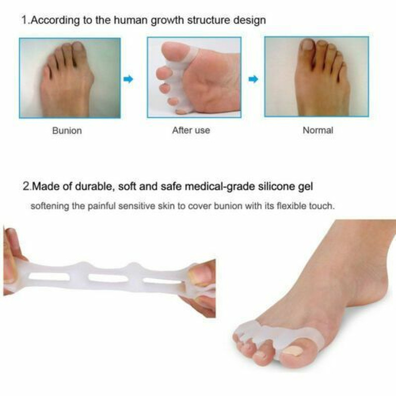 2-4Pcs Bunion Corrector Hammer Toe Straightener Splint Orthopedic Brace Silicone