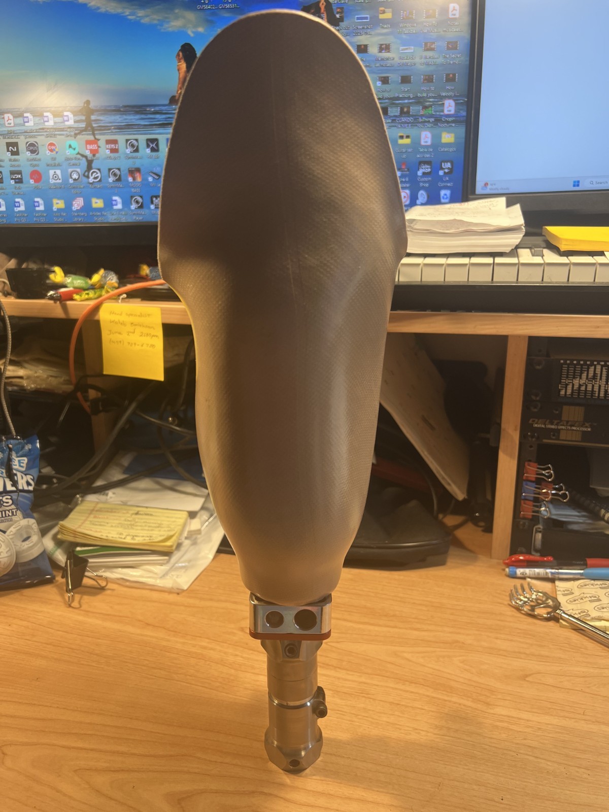 Prosthetic Socket with components. Right leg. Below Knee (BK). USED