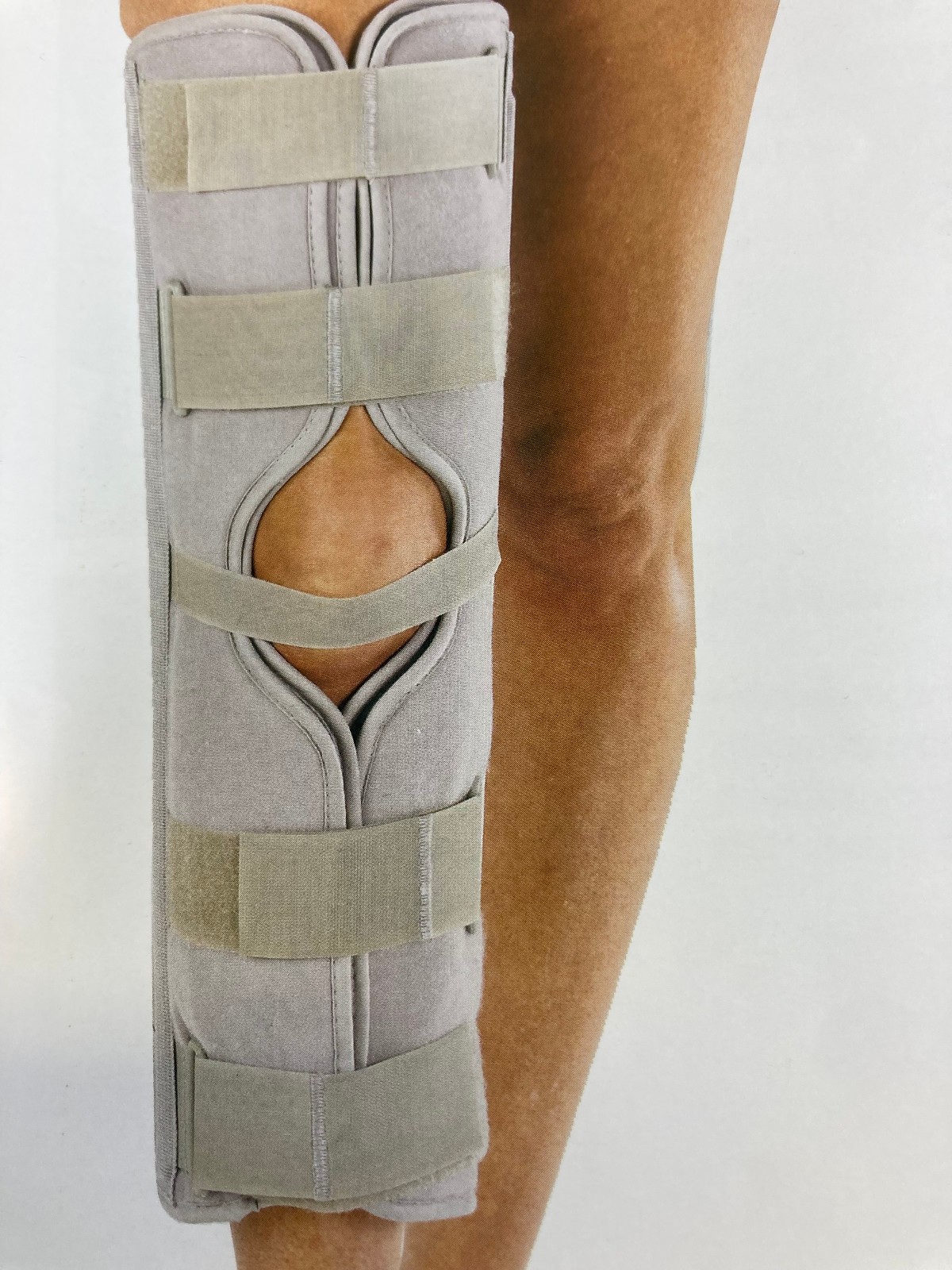 DJO ProCare 79-80010 3-Panel Knee Splint-12″-Universal