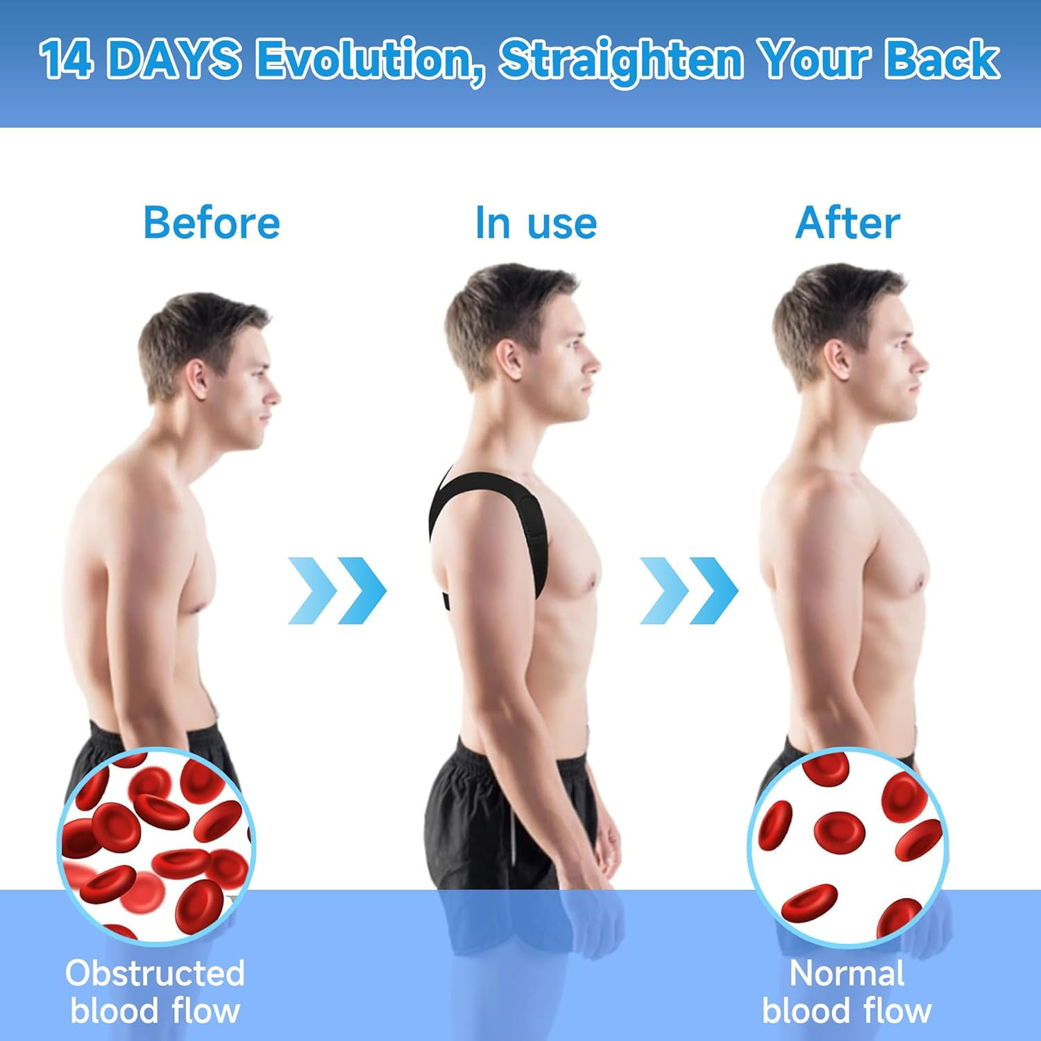 Back Straightener Posture Corrector for Women and Men, Adjustable Back Posture