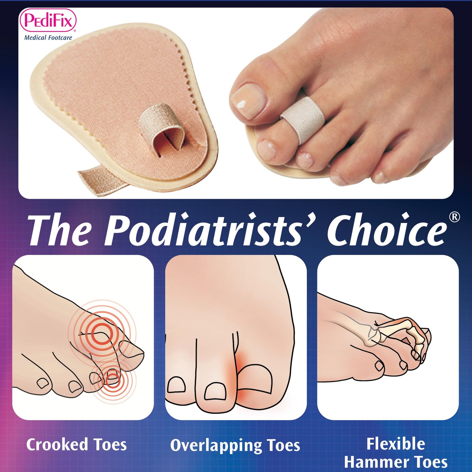 Podiatrists’ Choice Toe Straightener – 3-Pack Toe Aligners Gently Help Realig…