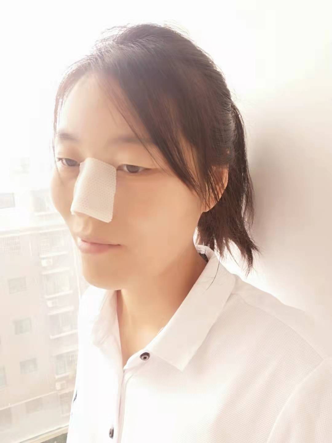 External Thermoplastic Nasal Splint with/without Sticker Tropezoid White 10pcs