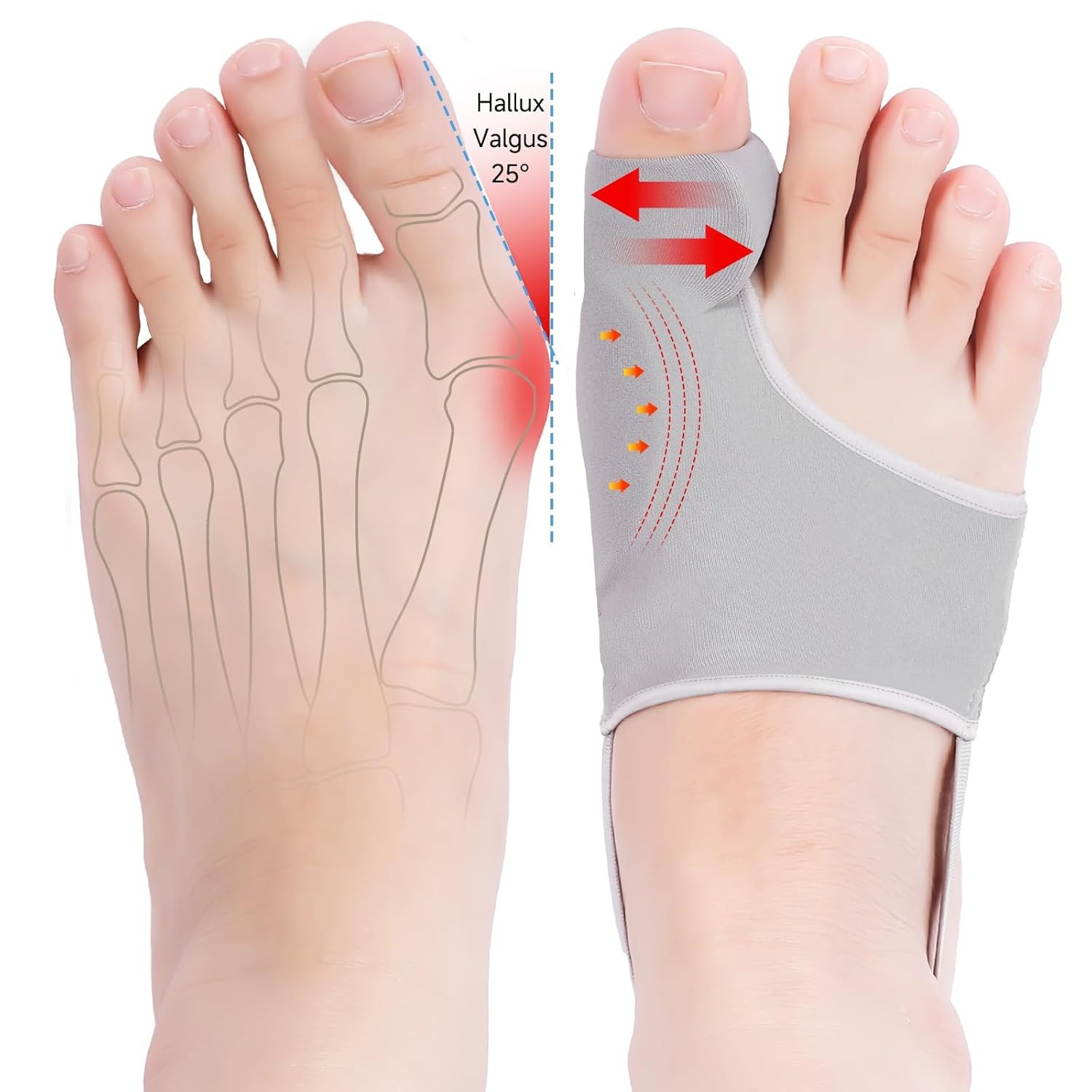 Toe Corrector Bunion Splint 2 Pack Adjustable Separator Support Brace Gray Foot