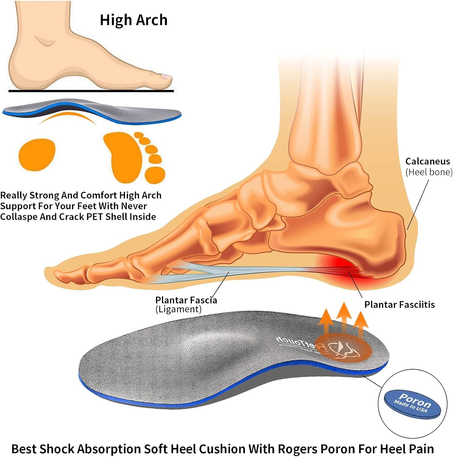 Strong Arch Support Orthotics for Metatarsalgia Mortons Neuroma,Ball of Foot…