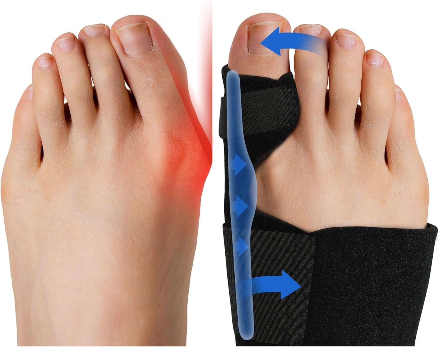 Fittest Pro Bunion Corrector (2pcs) FSA or HSA Eligible, Orthopedic Black