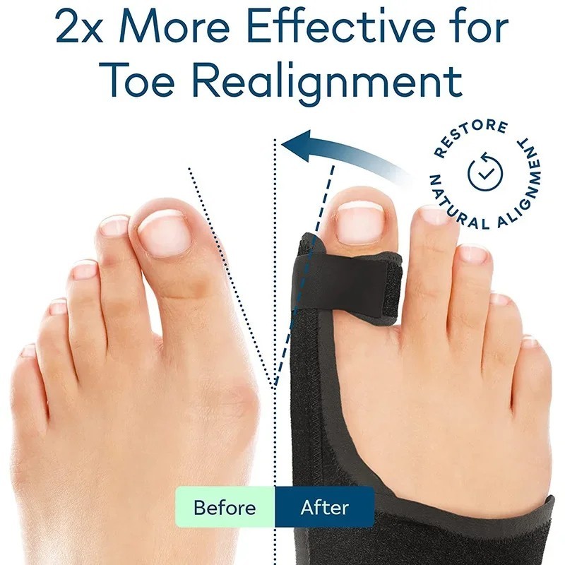 1 Pair Bunion Corrector Fix Hallux Valgus Adjustable Orthosis Women Men Splints