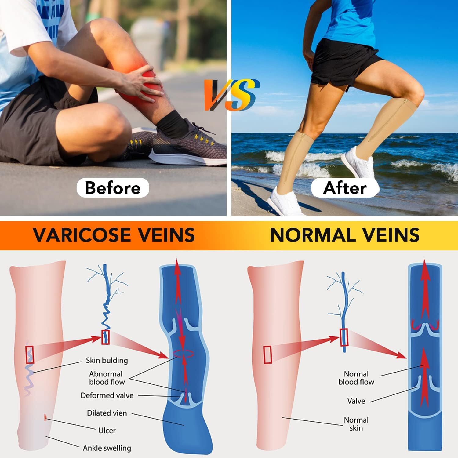 Compression Socks Toeless with Zipper Easy on off 20-30 mmHg for Varicose Veins