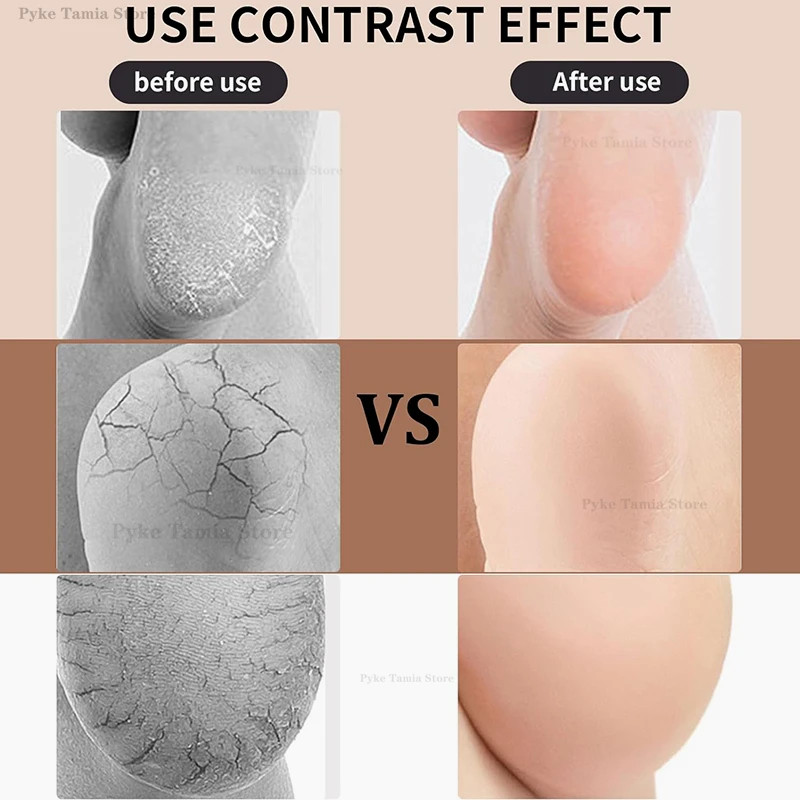 2pcs Heel Protective Cover Silicone Feet Care Anti-Crack Pain Relief Moisturizin