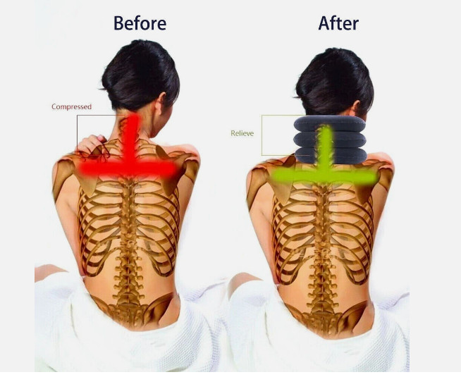 Cervical Neck Traction Device – Inflatable Collar for Neck Pain Relief