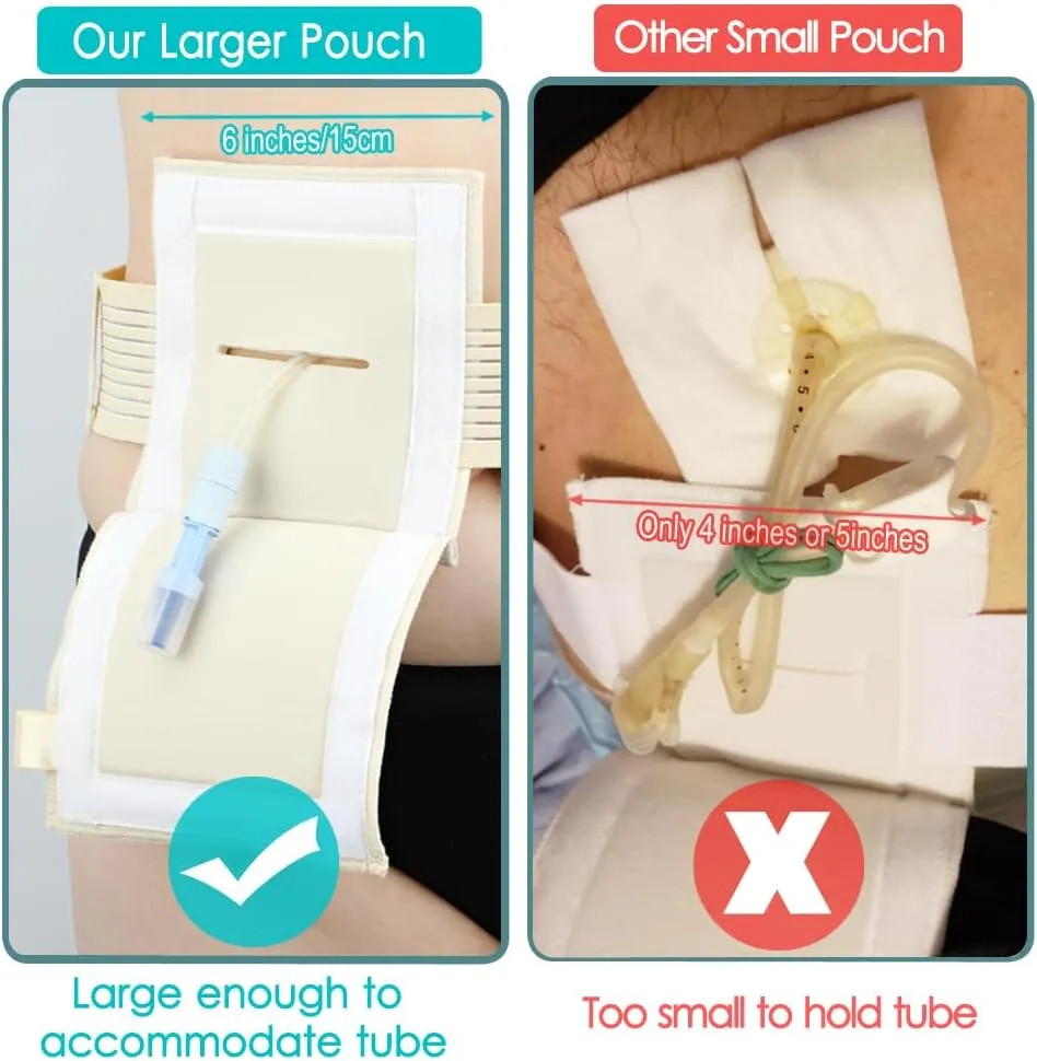 2 Pack Feeding Tube Belt G Tube Holder Protective Breathable Beige With Slit New