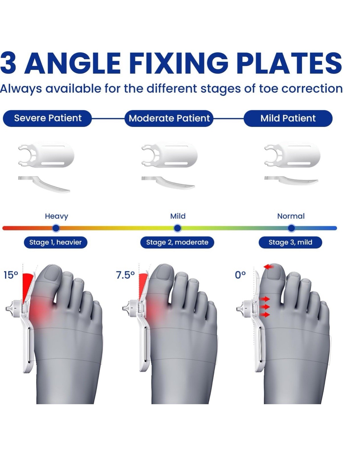 Bunion Corrector Splint for Big Toe – 3 Angle Plates, Hallux Valgus Relief