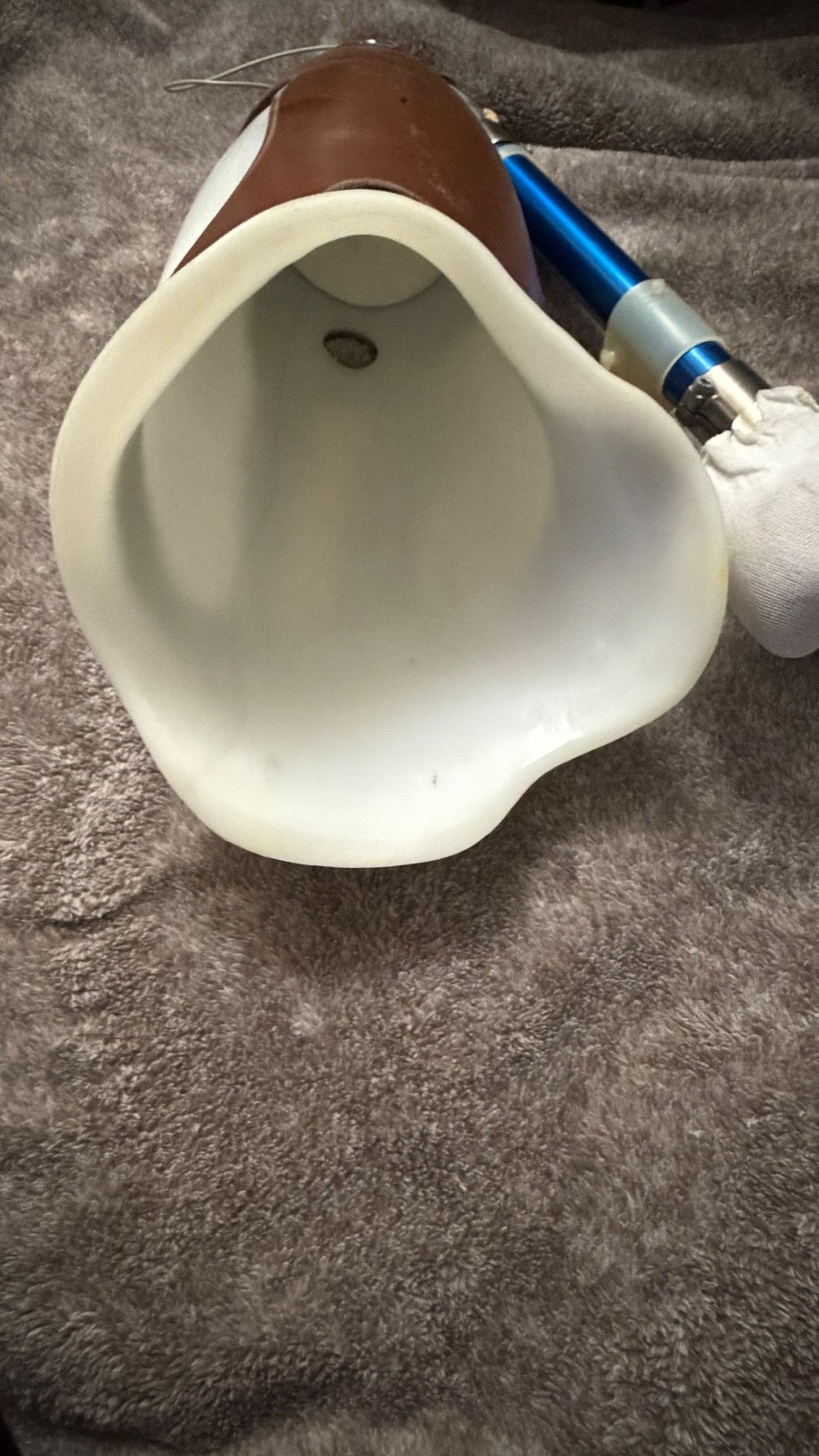 Vintage Ottobock Titan Left – Above the knee with Original Stub