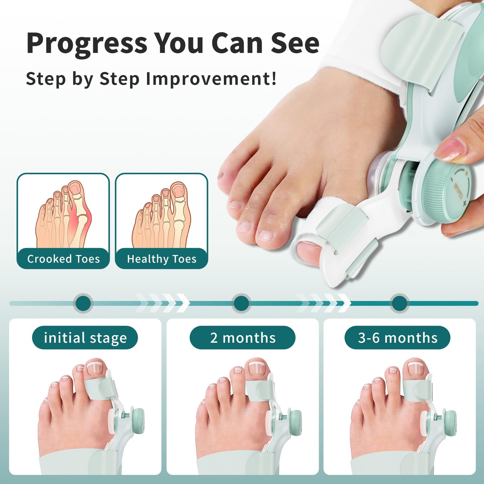 EliaValth 2 PCS Bunion Corrector for Women Big Toe, Adjustable Large, Green