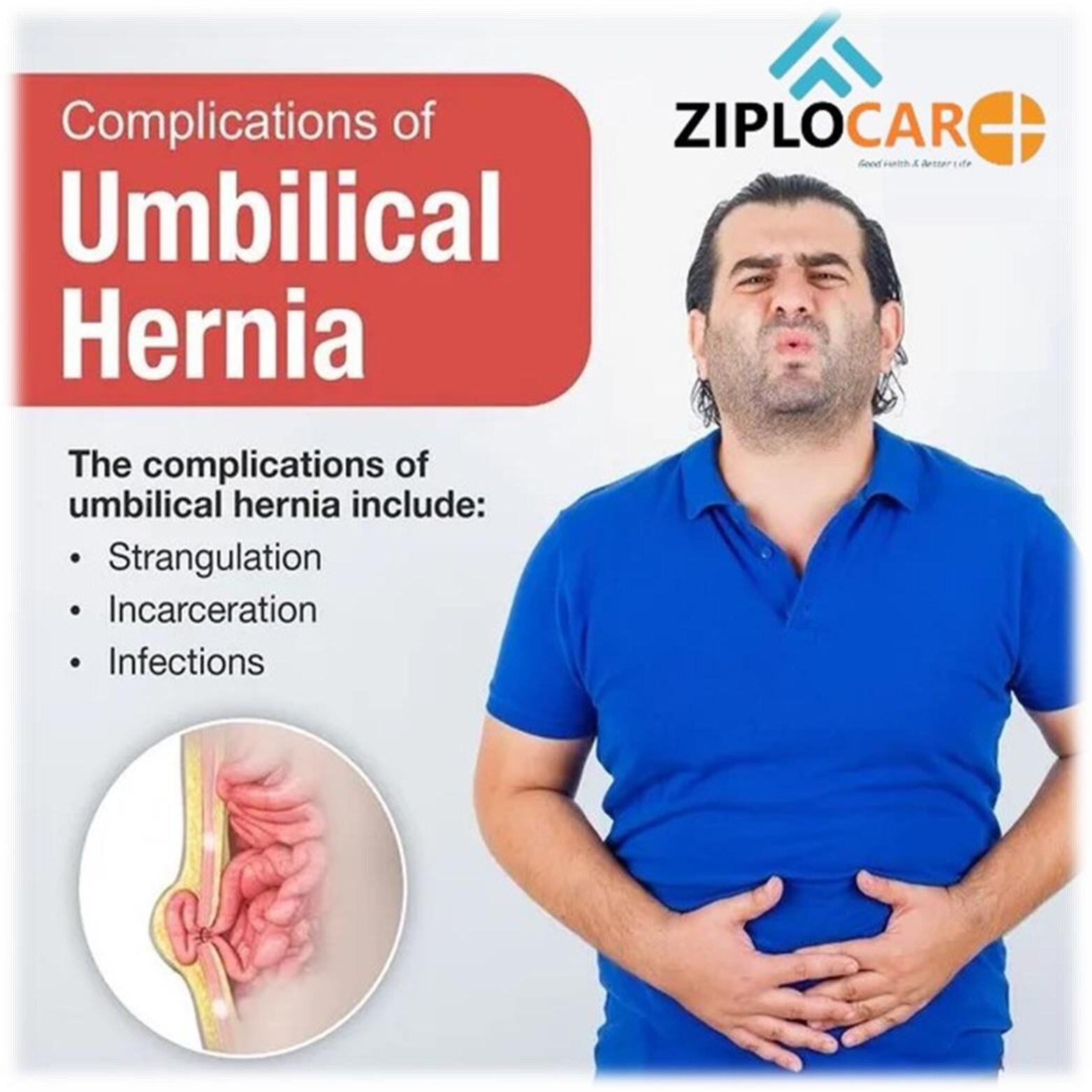 Umbilical Hernia Support Belt Belly Button Hernia Navel Truss Brace with Foam