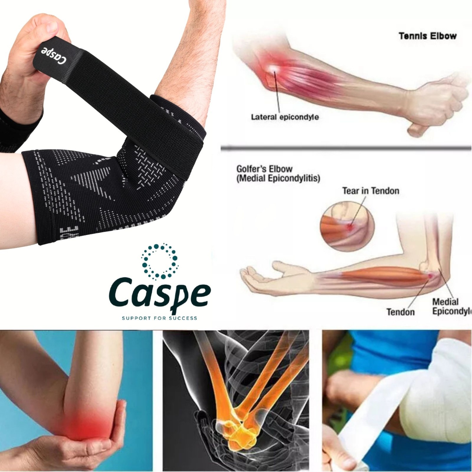 Caspe 2-Pack Elbow Sleeve Brace Wrap Adjustable Support Arm Arthritis Tendonitis