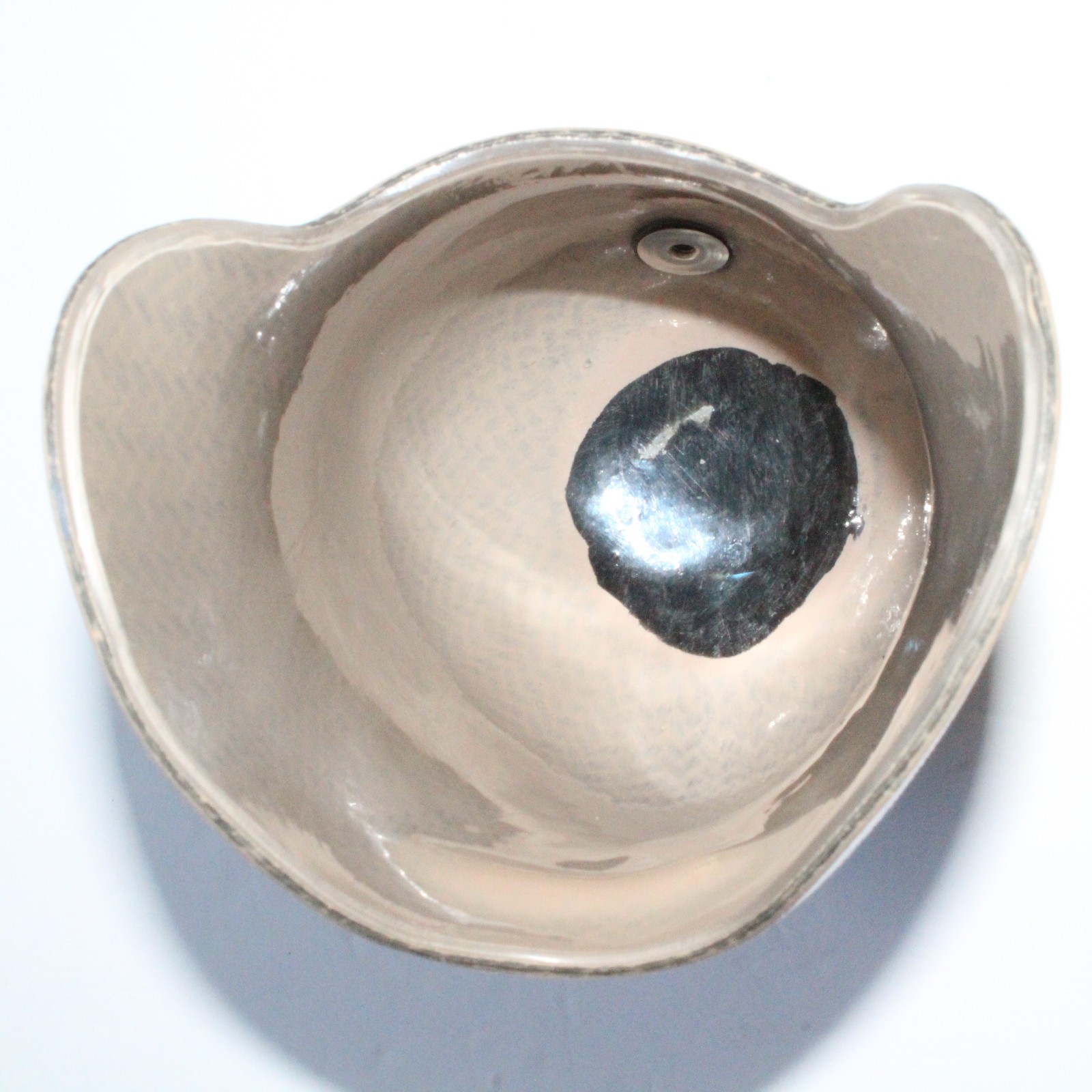 BELOW-KNEE PROSTHETIC SOCKET w/ EVOLUTION VMP-001 DISTAL BASE + VACUUM VALVE