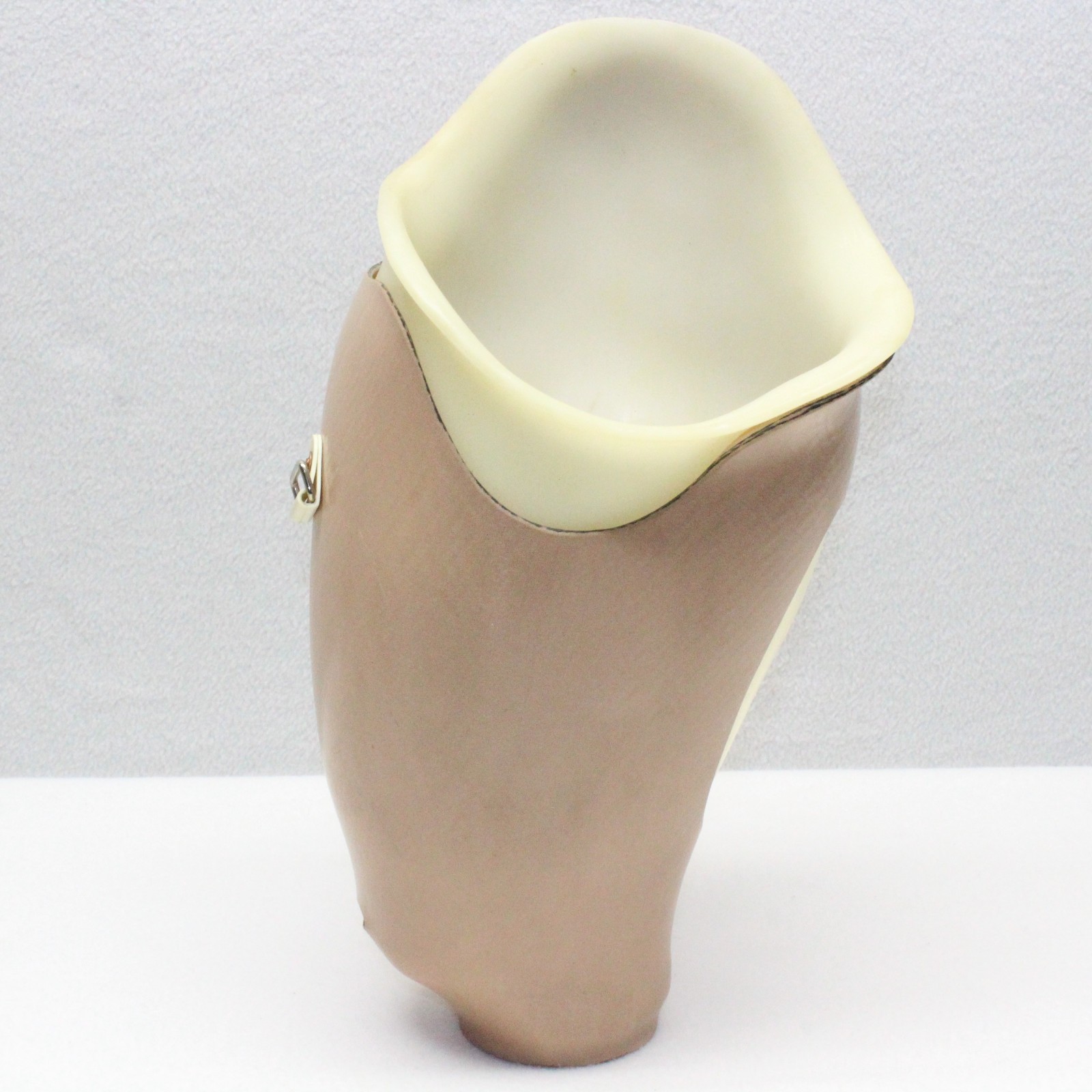 ABOVE KNEE PROSTHETIC LEFT LEG SOCKET SYSTEM w/ KISS DISTAL ~W=5.5×6″ H=9.5×14″
