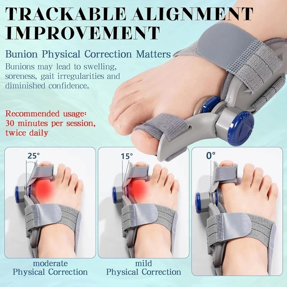 New Upgrade Treatmedy Bunion Corrector for Women & Men, Adjustable Bunion Fix Sp