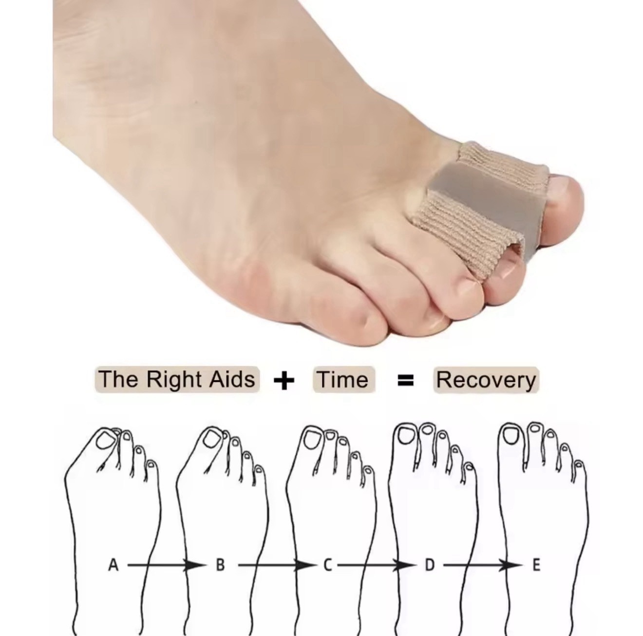 2Pcs – Two-Hole Toe Corrector Splitter Adjustable Stretchy Gel Elastic One Size