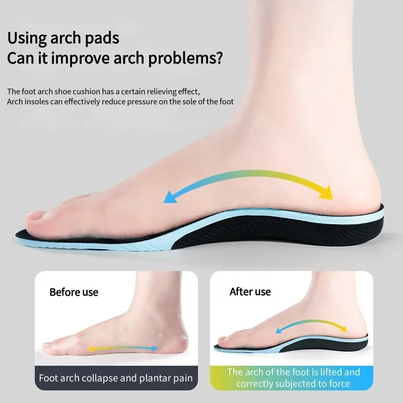 1Pair Orthopedic Pads Sports Shoes Insoles Arch Support Insole for Feet Plantar