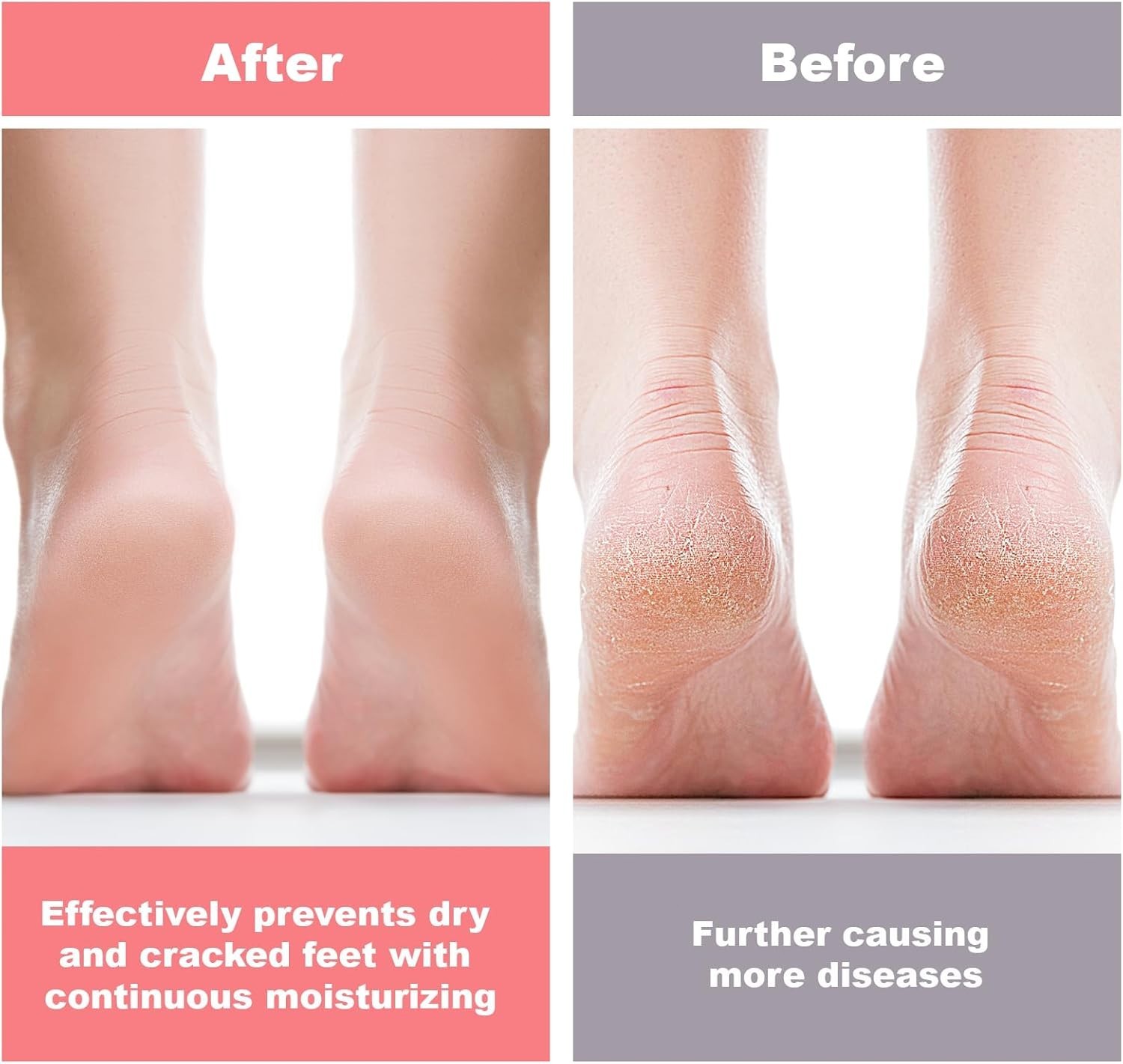 2 Pcs Silicone Foot Socks For Women Moisturizing Socks Foot Care Protector US