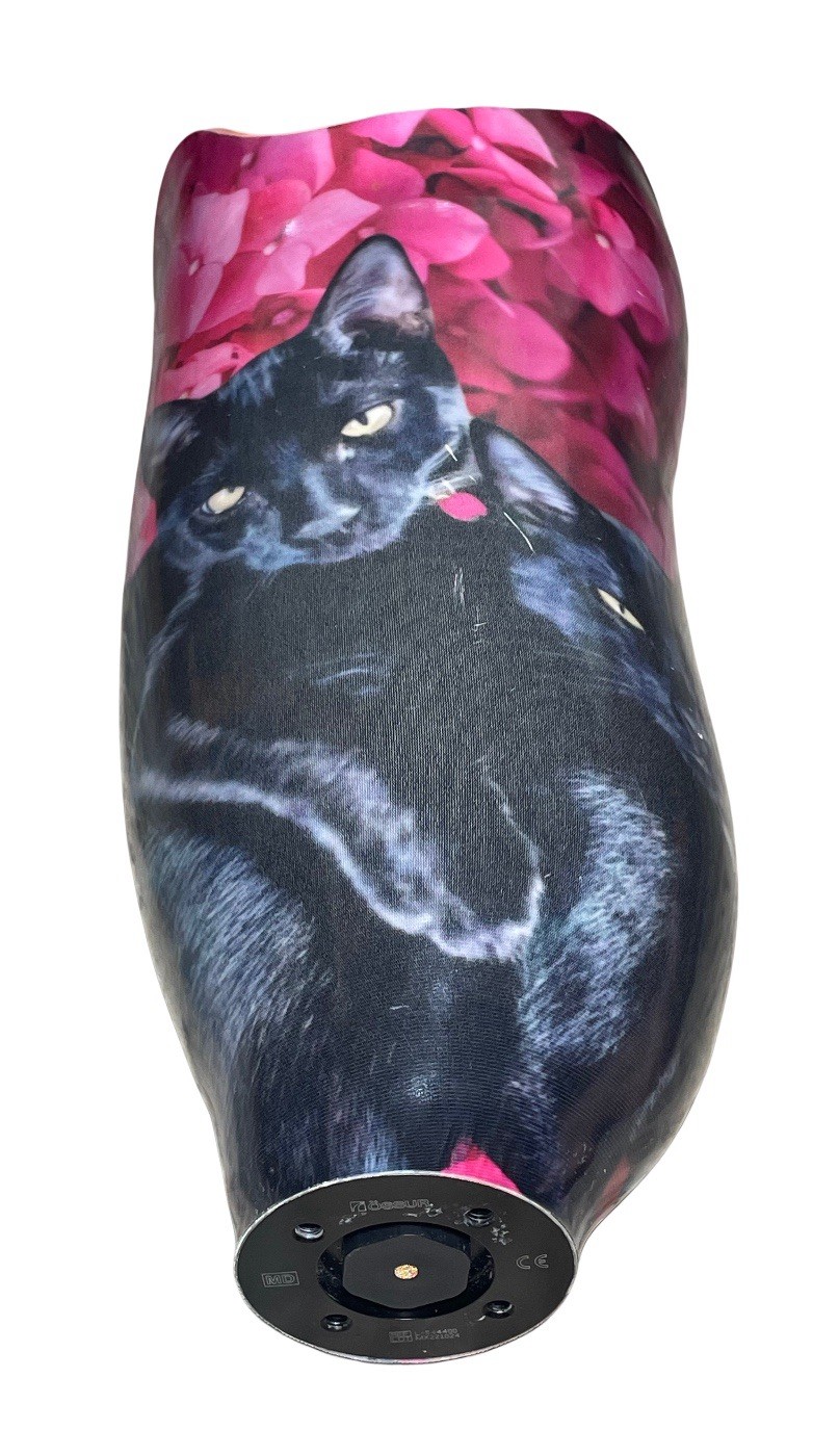 PROSTHETIC LEFT LEG ABOVE KNEE SOCKET w OSSUR ICELOCK L-544400 ADAPTER CATS